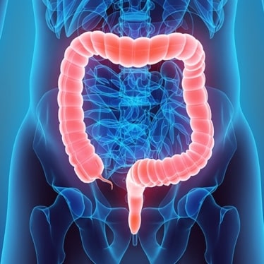 Colorectal Surgery