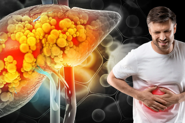 Fatty Liver Disease in Young Adults: Early Warning Signs, Causes, and Prevention Tips