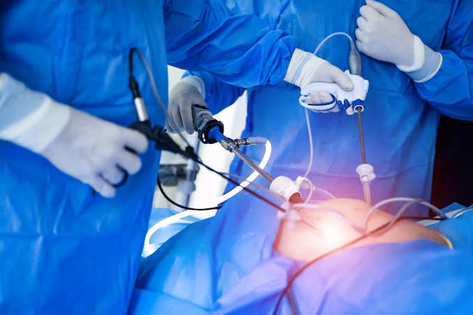 The Benefits of Laparoscopic Surgery: Why Minimally Invasive is the Future of Surgery