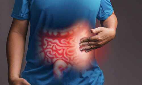 Understanding Inflammatory Bowel Disease (IBD): Symptoms, Types, and Treatment Options